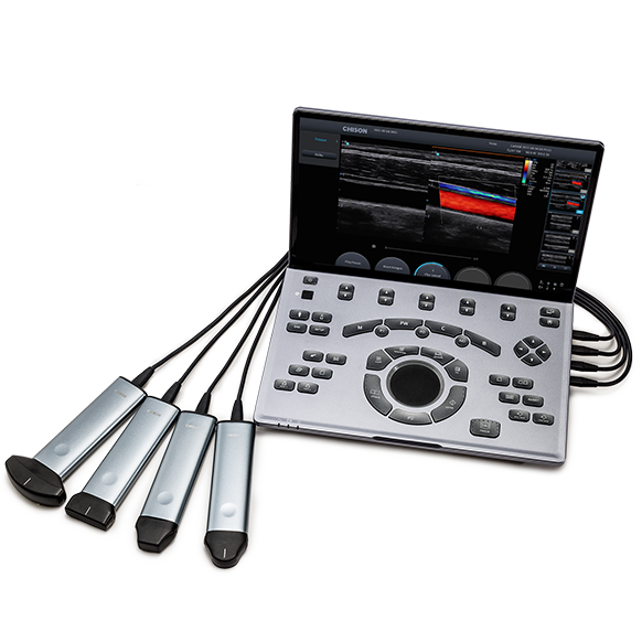 Chison Ultraschallgerät